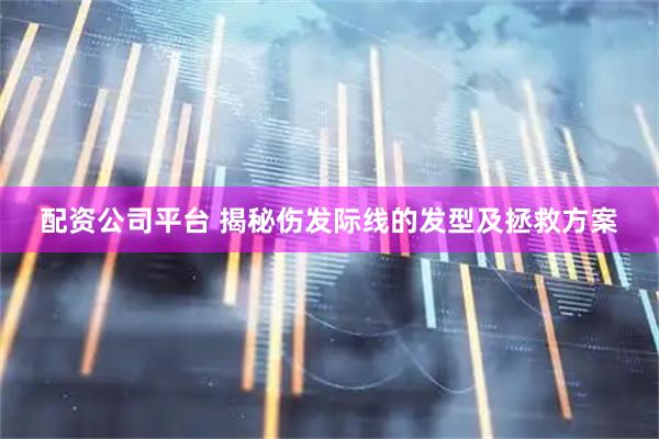 配资公司平台 揭秘伤发际线的发型及拯救方案